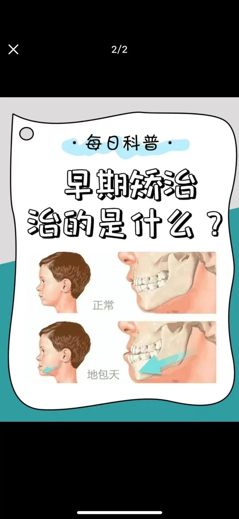 不矫正牙齿，危害究竟有多大？-图3