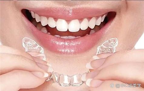 隐形矫正牙齿的最佳时间是什么时候？-图2