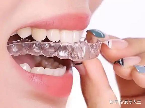 浙江牙齿矫正医院排名依据是什么？哪家医院更靠谱？-图1