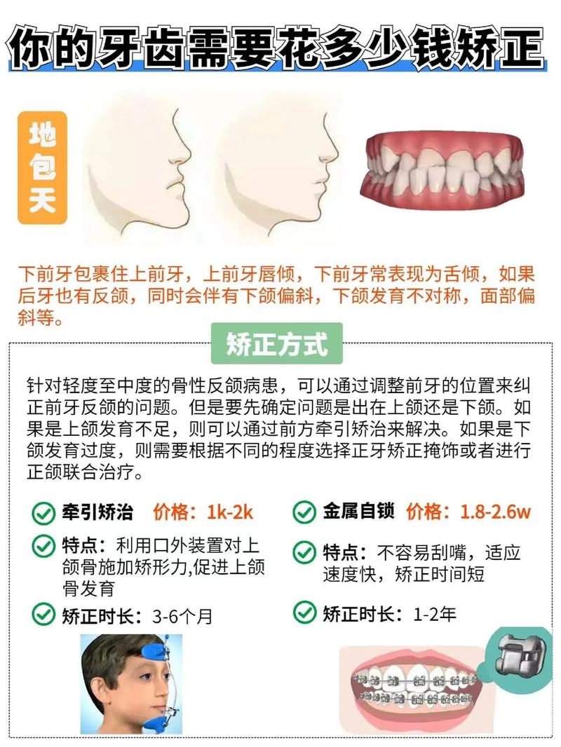 沈阳医大矫正牙齿价格大概在什么范围？-图2