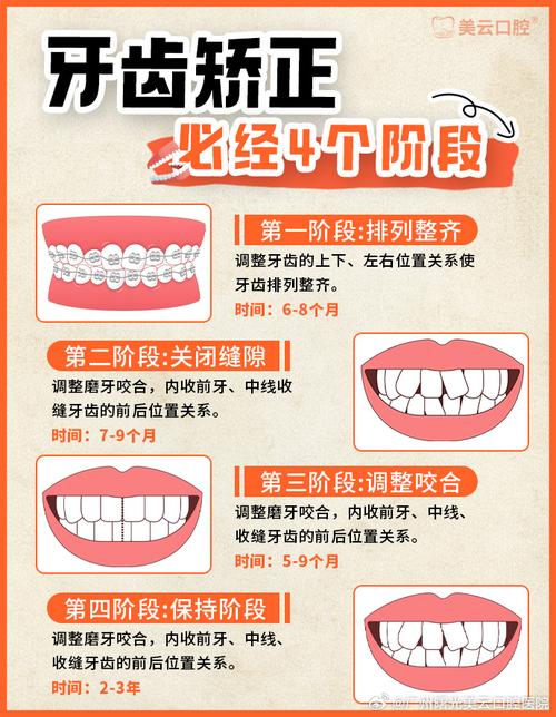 牙齿矫正怎么调整咬合-图1