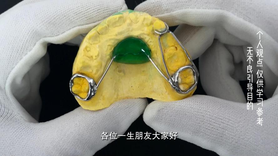 shiye牙齿矫正器矫正效果真的靠谱吗？使用体验如何？-图1