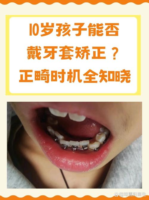 宝宝矫正牙齿的最佳年龄是什么时候？专家建议几岁开始？-图3