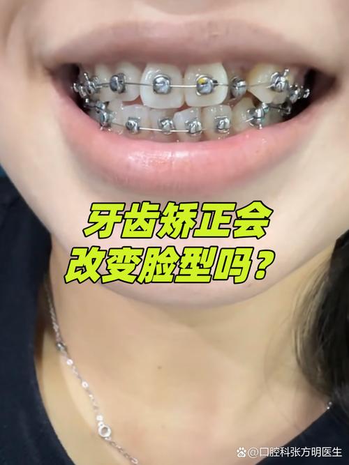 格莱美做牙齿矫正效果如何？体验好不好？值得推荐吗？-图2
