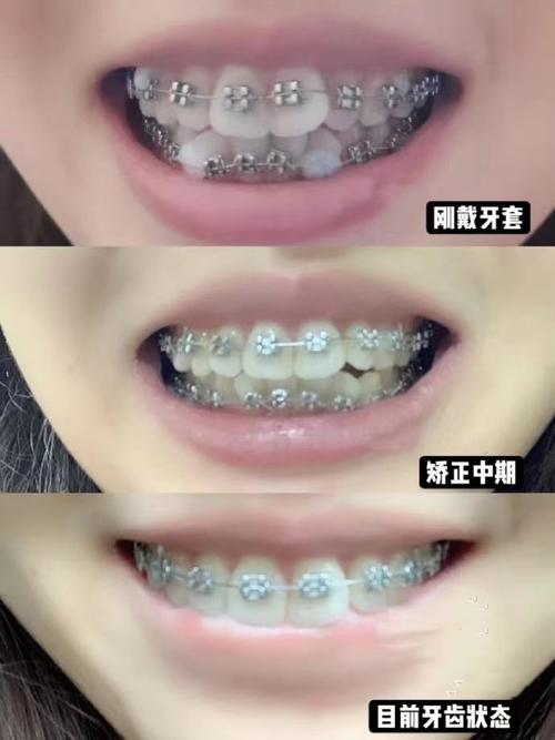 深圳矫正牙齿哪里找靠谱机构?-图2 深圳矫正牙齿哪里找靠谱机构?-图2