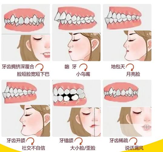苏州矫正牙齿哪里最好？靠谱机构怎么挑？-图2
