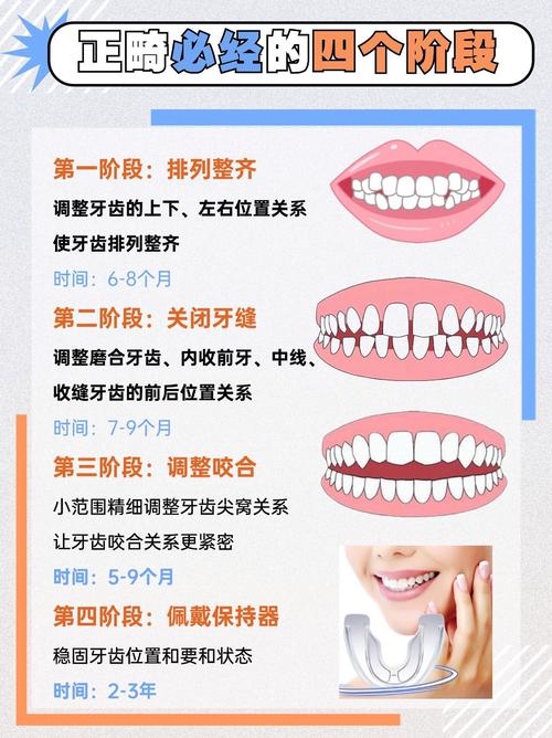 深圳隐形矫正牙齿分期怎么选？政策流程费用全攻略？-图1