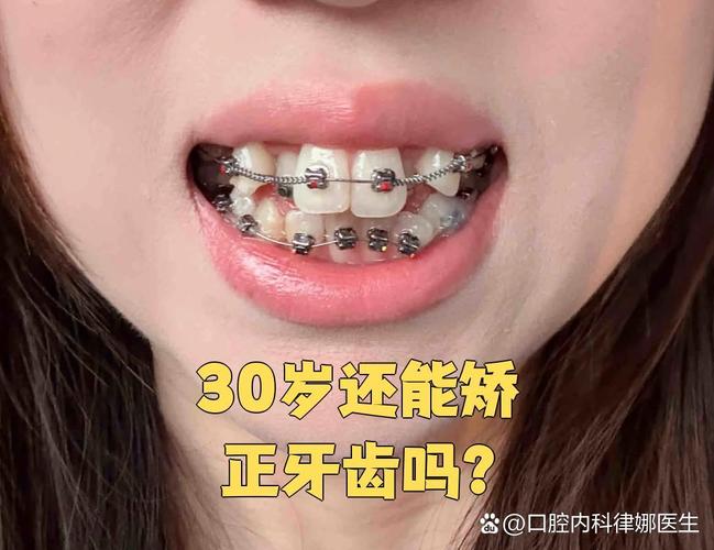 成人矫正牙齿过程图片-图2