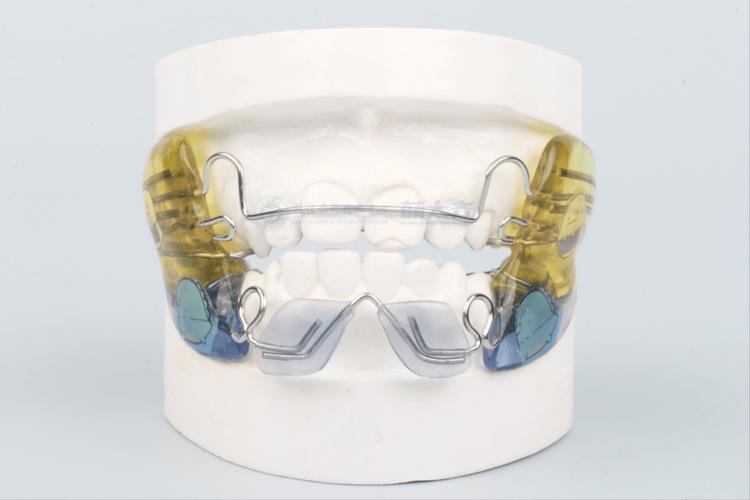 矫正牙齿有哪些矫正器类型？-图1