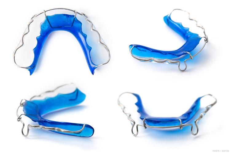 矫正牙齿有哪些矫正器类型？-图3