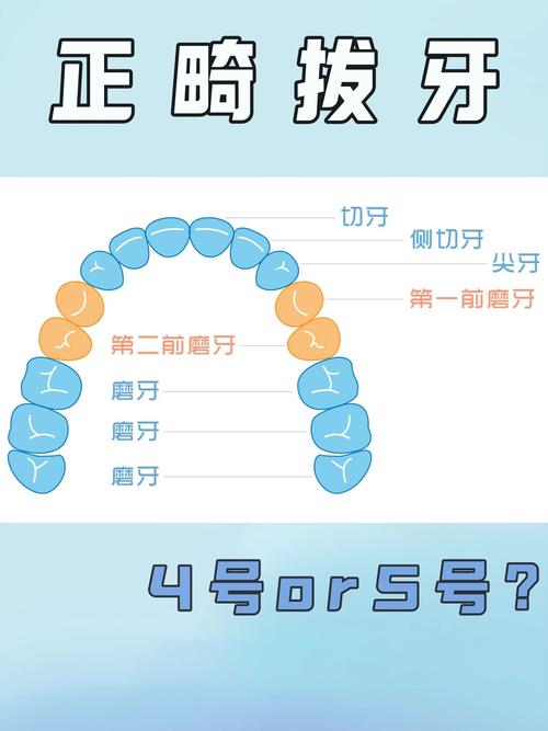 矫正牙齿拔哪几颗牙齿-图3