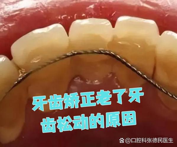 矫正牙齿老了牙齿松动-图1