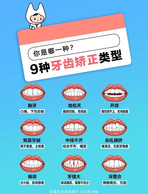 矫正牙齿能矫正几颗？数量有范围吗？-图2