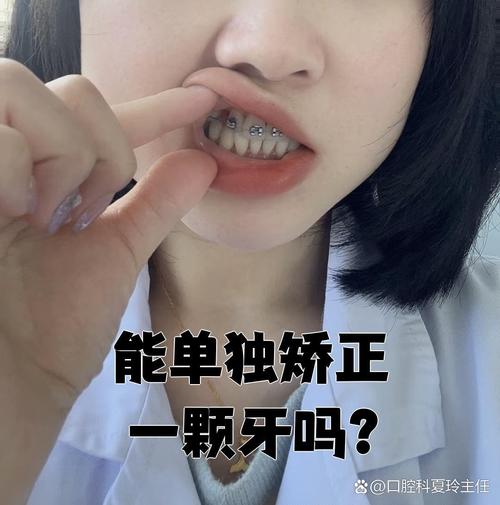 只矫正一颗牙齿可以吗？效果好不好，会不会影响邻牙？-图2