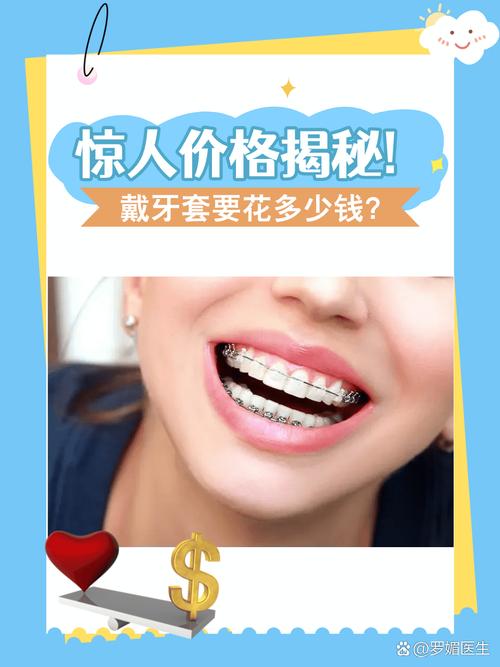进口牙齿矫正器价格是多少？-图3