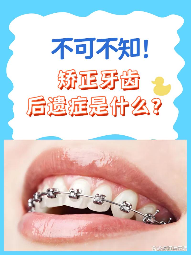 成年人矫正牙齿，这些后遗症你了解多少？-图3