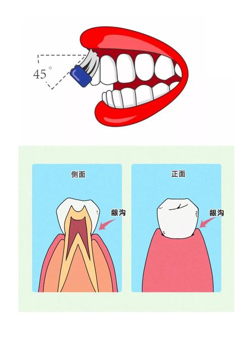 矫正牙齿后,一天究竟要刷几次牙才够?-图1 矫正牙齿后,一天究竟要刷几次牙才够?-图1
