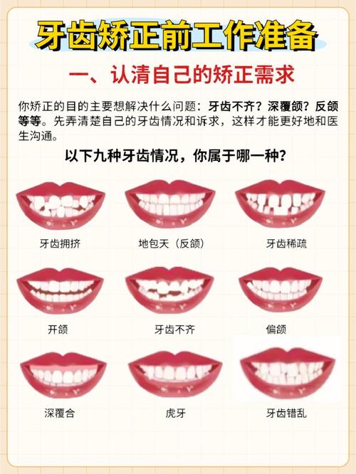 矫正牙齿后,一天究竟要刷几次牙才够?-图3 矫正牙齿后,一天究竟要刷几次牙才够?-图3