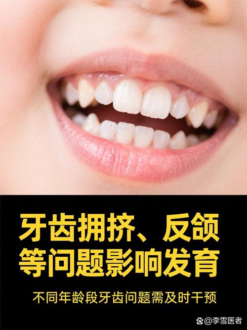 哺乳期矫正牙齿可行吗？对宝宝有影响吗？-图2