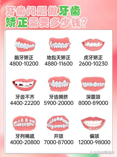 惠州矫正牙齿大概需要多少钱？-图1