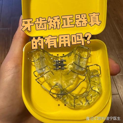 矫正牙齿期间,剧烈运动能做吗?会影响矫正效果吗?-图1 矫正牙齿期间,剧烈运动能做吗?会影响矫正效果吗?-图1