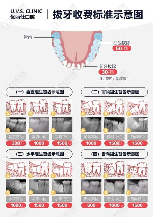 拔牙矫正牙齿多少钱？费用影响因素有哪些？-图1