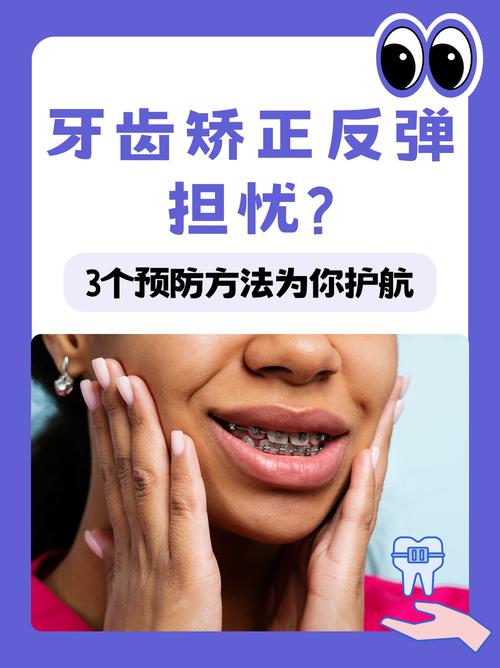 牙齿矫正后反弹,原因究竟是什么?-图3 牙齿矫正后反弹,原因究竟是什么?-图3