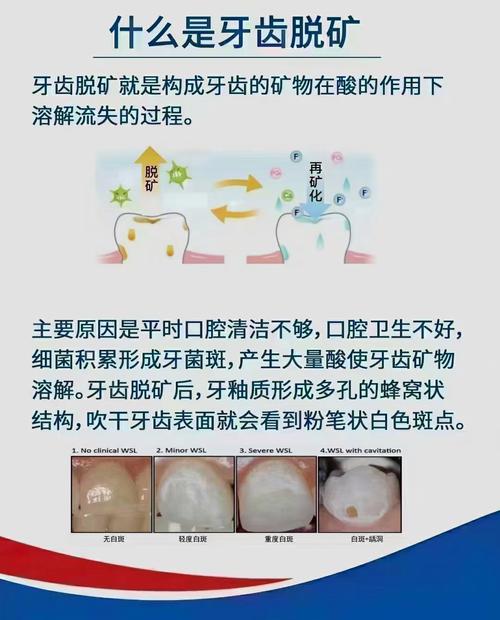 牙齿矫正后需要洗牙吗-图2