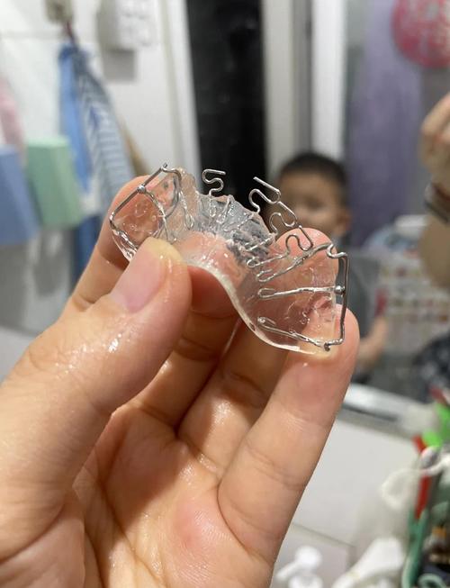 地包天牙齿矫正该怎么做？-图2