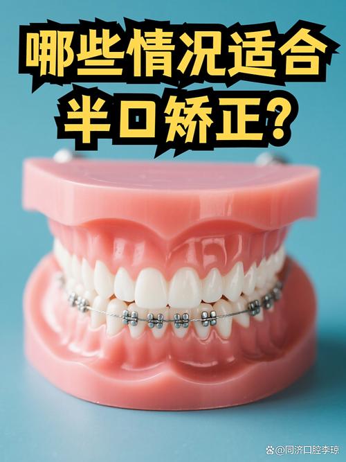 矫正牙齿对牙齿有损伤吗？-图2