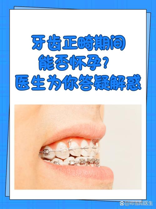 怀孕期间能做牙齿矫正吗？安全注意事项有哪些？-图1