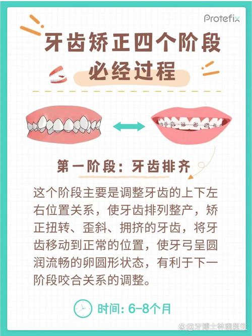 牙周不好能矫正牙齿吗-图2