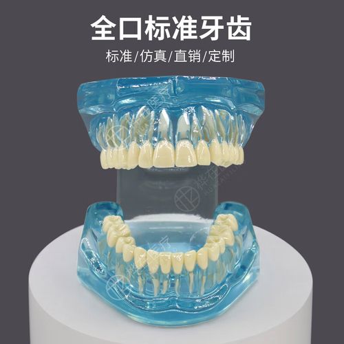 矫正牙齿做牙模要多久-图2