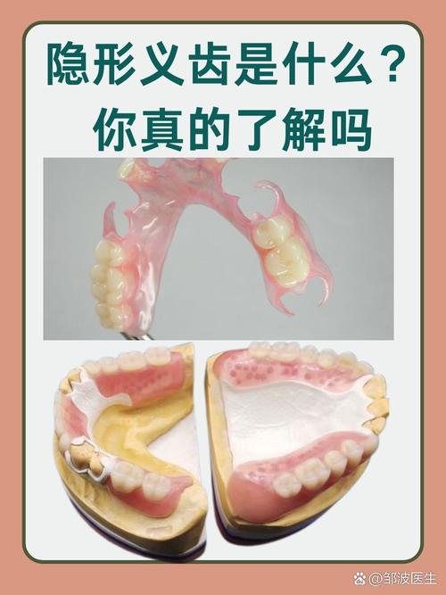 隐形矫正牙齿有后遗症-图2