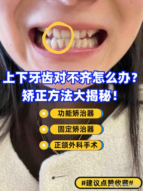 下排牙齿不齐能矫正吗?效果能维持多久?-图1 下排牙齿不齐能矫正吗?效果能维持多久?-图1