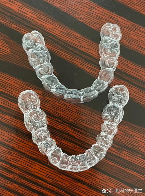 隐形矫正器效果如何？与传统矫正有何不同？-图1