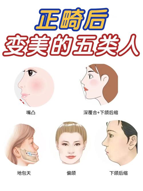 矫正牙齿会改变嘴型吗？嘴型变化受哪些因素影响？-图2