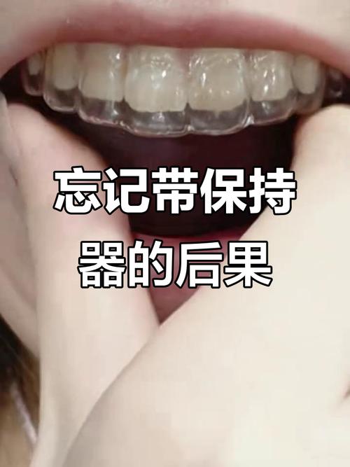 矫正后不戴保持器，牙齿会反弹吗？-图2