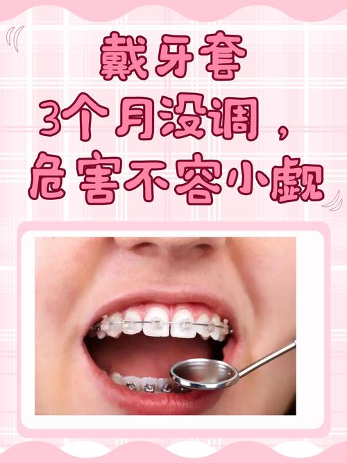 矫正牙齿必须戴牙套吗？还有其他矫正方式吗？-图2