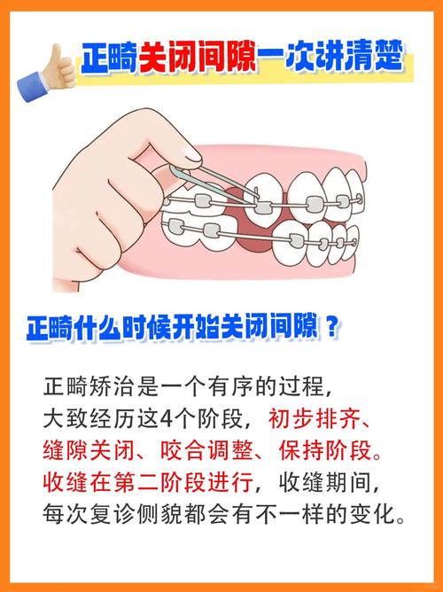 牙齿中间有缝能矫正吗？-图1
