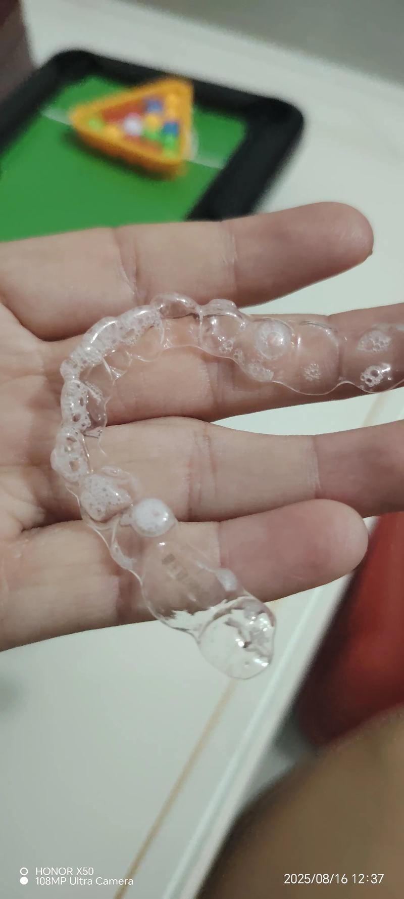 6号牙拔了能矫正牙齿-图2