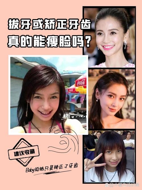 明星牙齿矫正前后对比照曝光，颜值变化究竟有多惊艳？-图1