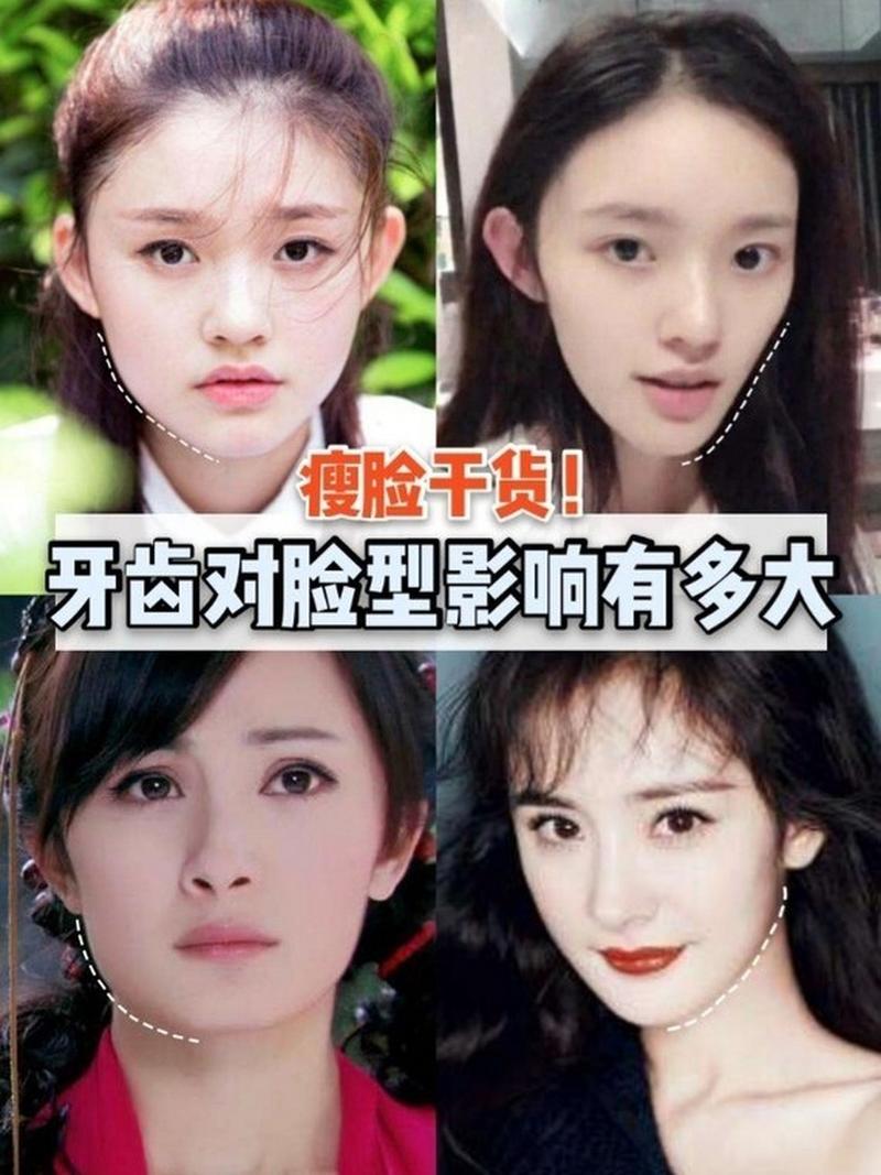 明星牙齿矫正前后对比照曝光，颜值变化究竟有多惊艳？-图2