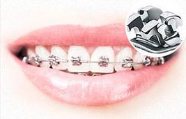 北京牙齿矫正去哪里做比较好？-图2