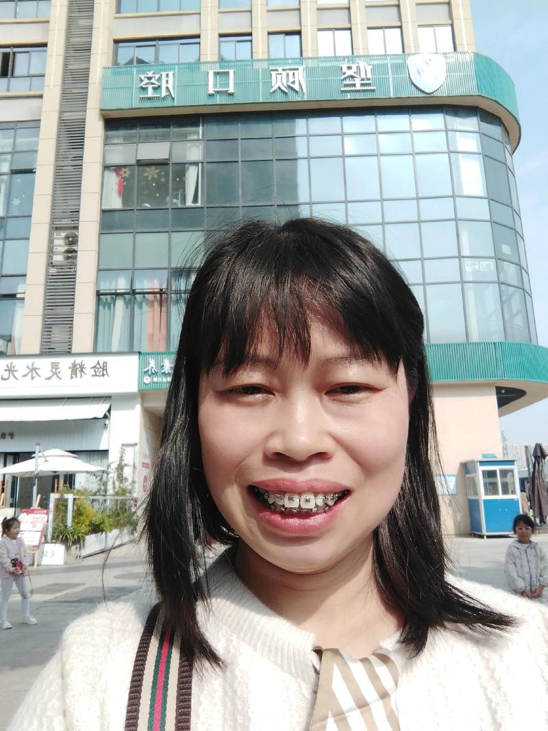 31岁矫正牙齿还来得及吗?-图2 31岁矫正牙齿还来得及吗?-图2