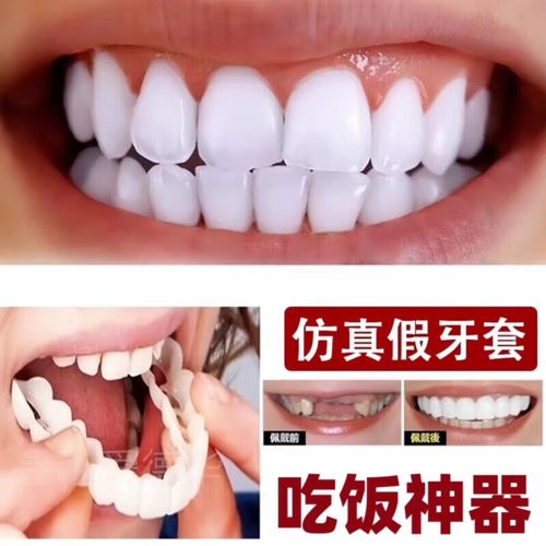 牙齿矫正后要等多久才能正常吃饭呢？-图2