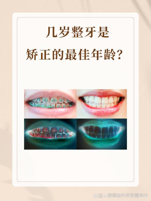 40岁矫正牙齿要多久-图1