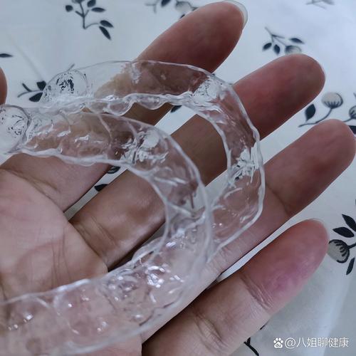 牙齿矫正后不带保持器，矫正效果真的会反弹回原样吗？-图1