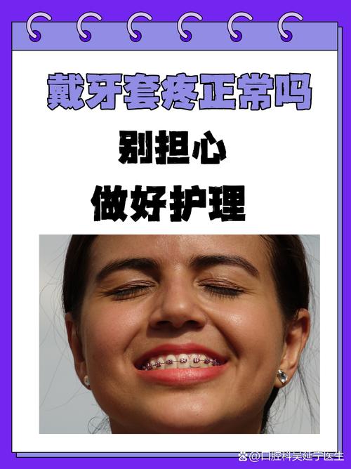 矫正牙齿可以喝酸奶吗-图1