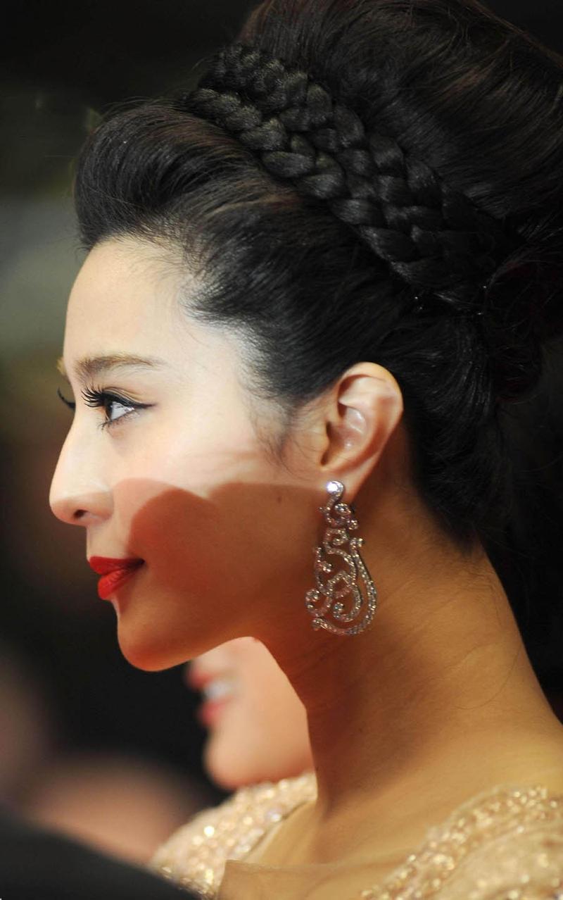 范冰冰牙齿矫正图片引热议，矫正效果究竟如何？-图2